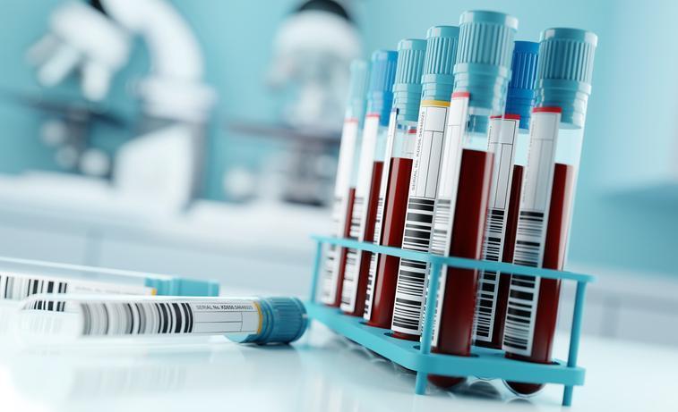 Dünyaca ünlü uzun ömür araştırmacısı, sağlıklı yaşlanmak için aldığı 4 takviyeyi açıkladı: 'Ucuz, güvenli ve bana sorarsanız önemli' 9 dunyaca unlu uzun omur arastirmacisi saglikli yaslanmak icin aldigi 4 takviyeyi acikladi ucuz guvenli 9NzU5JlQ