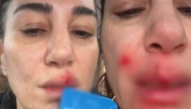evde talihsiz kaza bir anda kanlar icinde kaldi LJ9M15pJ