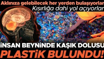 insan beyninde bir kasik dolusu plastik bulundu yemeklerden ve havadan geciyorlar tek tek hucrelerin BnULz7Zi