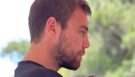 murat dalkilic burnundan 11inci kez operasyon gecirdi Be3uaXHl