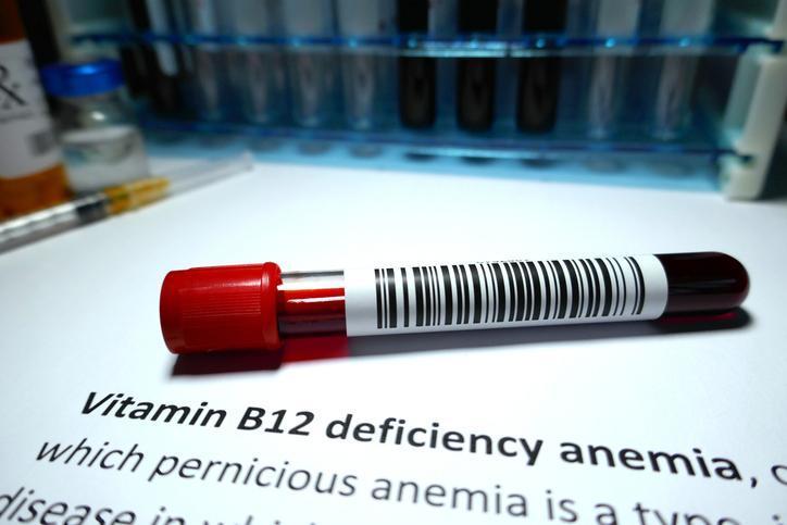 Sessiz tehdit: B12 eksikliği karaciğer hastalığına bile davetiye çıkarıyor 7 sessiz tehdit b12 eksikligi karaciger hastaligina bile davetiye cikariyor 6 uOb6HLuX