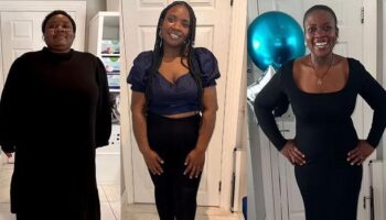uzmanlar mide ameliyati olmasi gerektigini soylemisti 11 diyeti sayesinde 77 kilo verdi artik buyuk wxZetx4N