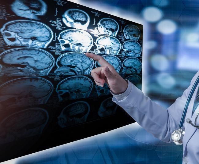 Bilim insanları yeni bir ‘harika takviye’ keşfetti! Bacopa bitkisinin etkileri şaşırttı… Hangi yöntemlerle tüketiliyor? 8 bilim insanlari yeni bir harika takviye kesfetti bacopa bitkisinin etkileri sasirtti hangi yontemlerle tuketiliyor SBlMGImp