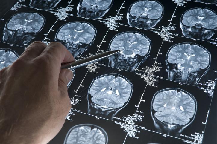 Bilim insanları yeni bir ‘harika takviye’ keşfetti! Bacopa bitkisinin etkileri şaşırttı… Hangi yöntemlerle tüketiliyor? 7 bilim insanlari yeni bir harika takviye kesfetti bacopa bitkisinin etkileri sasirtti hangi yontemlerle tuketiliyor Xe6PIrFF