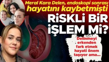 endoskopi riskli bir islem mi bagirsak veya midede olusan delinmeyi erkenden fark etmek hayati DVnTCKXf