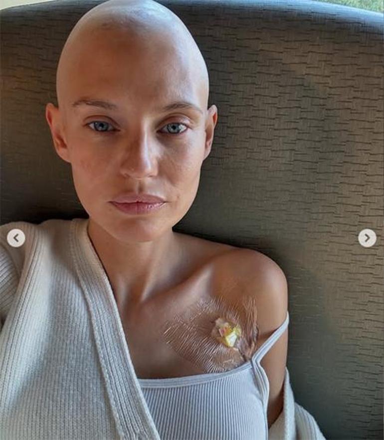 Kanserle boğuşan ünlü model sahneye çıktı… Bu ancak ayakta alkışlanır... En cesur savaşçı! 7 kanserle bogusan unlu model sahneye cikti bu ancak ayakta alkislanir en cesur savasci 6 4ASjWNIy