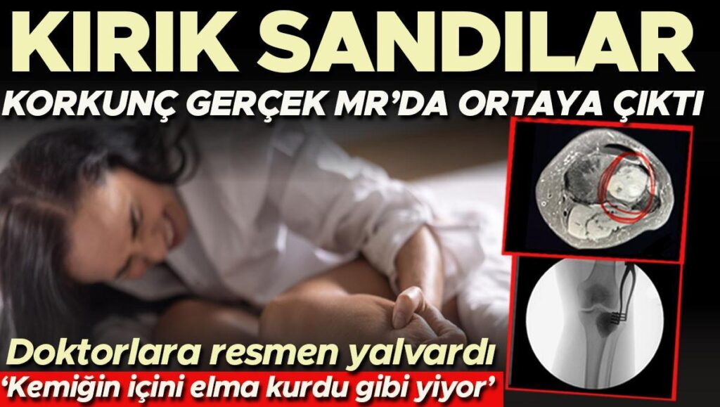 kirik sandilar ama gercek mr sonucunda ortaya cikti elma kurdunun elmayi yemesi gibi kemiklerin dSb5LsjR