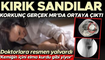 kirik sandilar ama gercek mr sonucunda ortaya cikti elma kurdunun elmayi yemesi gibi kemiklerin dSb5LsjR