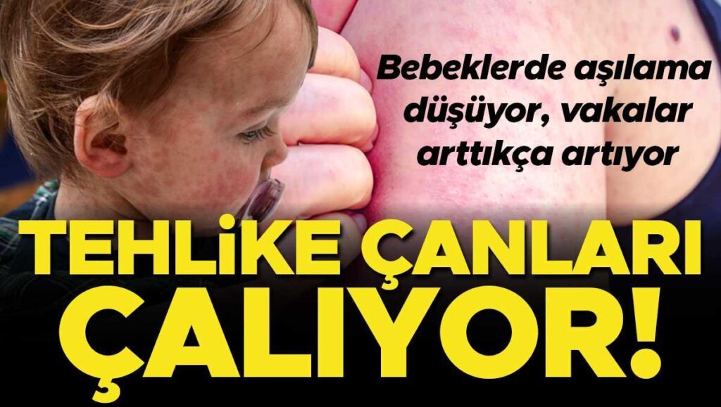 kizamik vakalari her gecen gun artiyor asilama oranlari ise dusuyor turkiyede durum ne kizamik qQzSOVAR