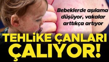 kizamik vakalari her gecen gun artiyor asilama oranlari ise dusuyor turkiyede durum ne kizamik qQzSOVAR
