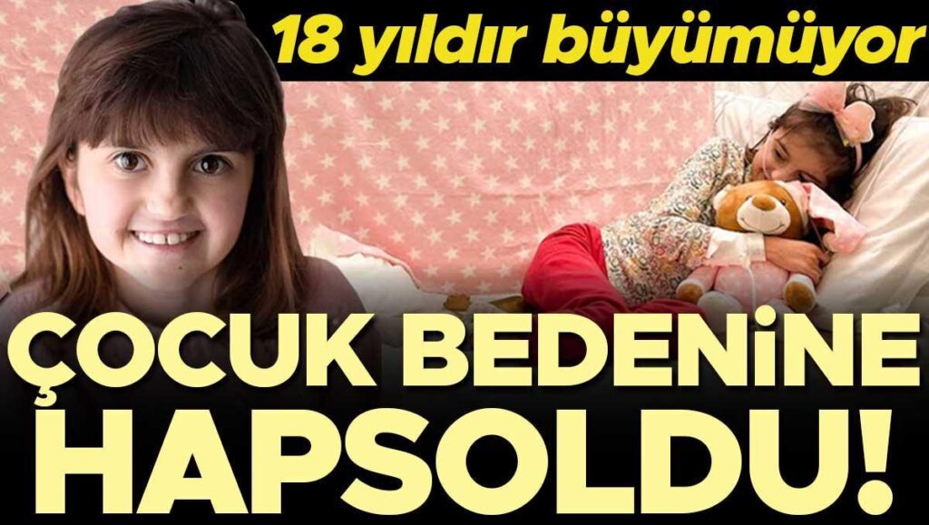 oyle bir hastalik ki genc kizi cocuk bedenine hapsetti 18 yildir neredeyse hic buyumuyor 7VpLep1c