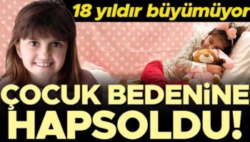 oyle bir hastalik ki genc kizi cocuk bedenine hapsetti 18 yildir neredeyse hic buyumuyor 7VpLep1c