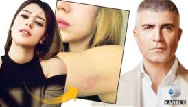 ozcan denizin eski esi feyza aktandan darp iddiasina yanit sHrYp2rA