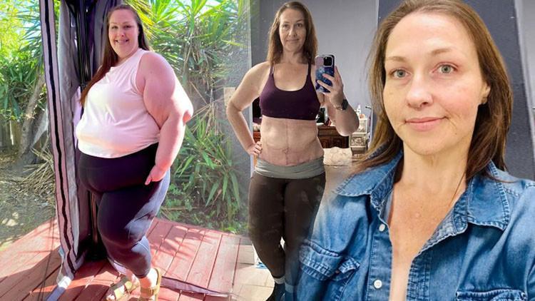 Yaşadığı değişime kendisi bile inanamıyor: 197 kilodan 95 kiloya düştü! ‘Artık hayattan daha fazla zevk alıyorum’ 1 yasadigi degisime kendisi bile inanamiyor 197 kilodan 95 kiloya dustu artik hayattan daha fazla iG1iLeMq